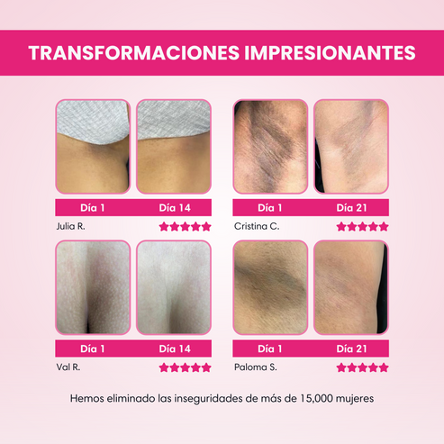 Zalia™ - Unifica tu piel al instante